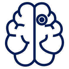 Meningioma Treatment